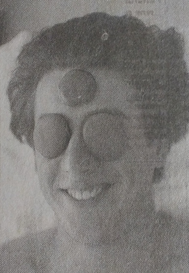 Fabricio Rocha com pedras quentes no rosto em foto de jornal